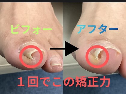 巻き爪本舗 津田沼店の写真
