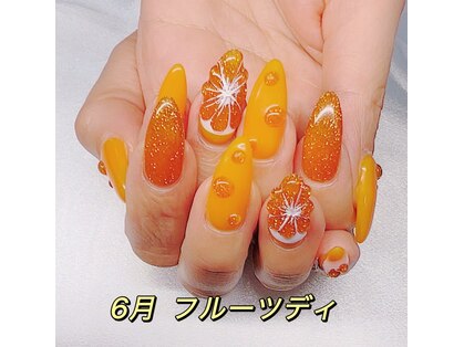 ラックス(LAXX)の写真