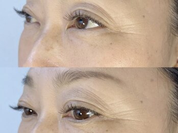 アイサロン 希(のぞみ)の写真/LEDエクステでキープ力向上！メイクの時短に繋がる大人女性の自然なまつ毛デザイン