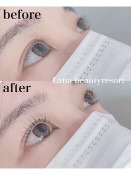 ラナビューティリゾート(Lana Beauty resort)/アップラッシュリフト