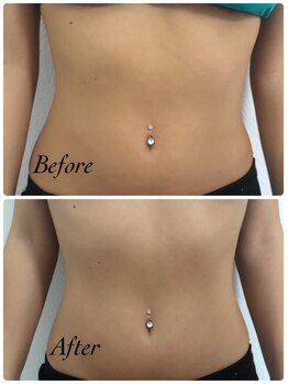 ミント(M’int)/お腹の効果写真