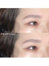 フレイズラピス(FRASE Lapis)/ハリウッドブロウリフト