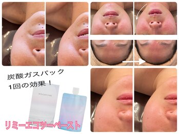ラ ルミエール(La Lumiere)/炭酸ガスパックがオススメ！