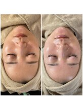 ミーミドットアイ(Mi-mi.i)/トーンアップ、肌質改善★