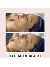 トレス(Tres)/インディバ×シャトーデボーテ