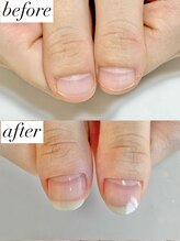 ニコワイズネイル(Nico Y's Nail)/【自爪育成コース】