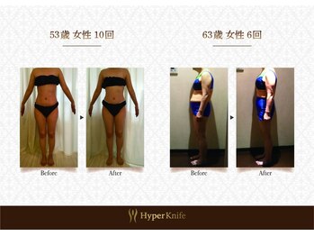 ハンズ鍼灸接骨院小牧院 美容整体ハンズ(美容整体hands)/痩身 before after