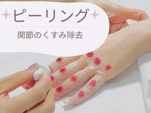 アンドシー(&C)/＊ピーリング＊