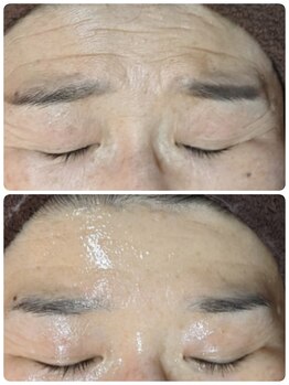 ウララ(ulala)/60代前半セルマンビフォアフ