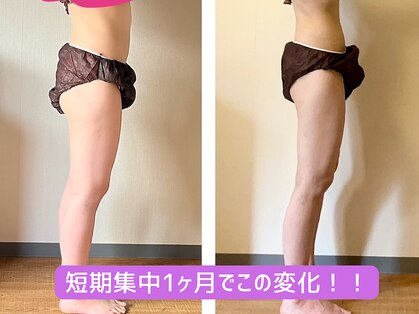 ヨサパーク ケリビオラ(YOSA PARK keli美ola)の写真