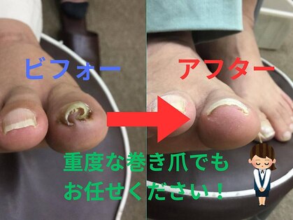 巻き爪本舗 津田沼店の写真
