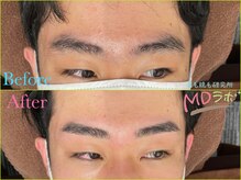 エムディラボ 金沢竪町店(MDラボ)/BeforeAfter