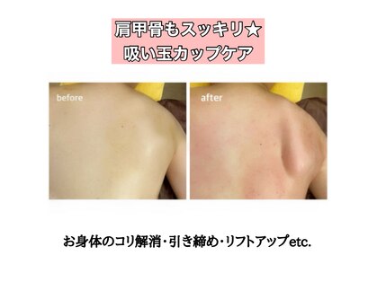 エステ イン アンヌドゥールの写真