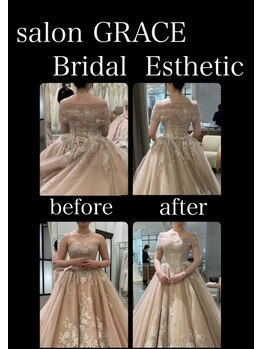 サロン グレイス(salon GRACE)/