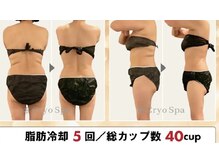 アリス 赤坂