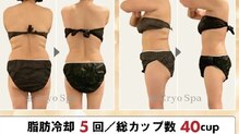 アリス 赤坂