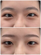 コアバイサラ 山口店(koa by SARA)/▲▼眉毛ＷＡＸ▼▲