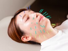 かがりの整骨院 鍼灸院