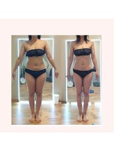 エミフル(EMIFULL)/