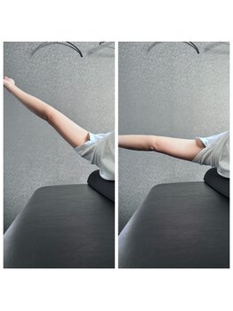 ナオル整体 大阪京橋院(NAORU整体)/ Before After【猫背】