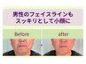 メンズもスッキリ小顔に☆シュっと見え叶う小顔矯正マッサージ52%off¥4,300