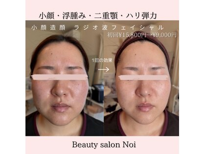 ノイ(Noi)の写真