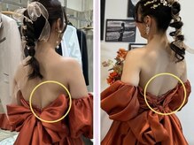 グランボディ 蟹江店(GranBody)/30代女性ビフォーアフター