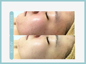 アコガレコガオ 仙台店/