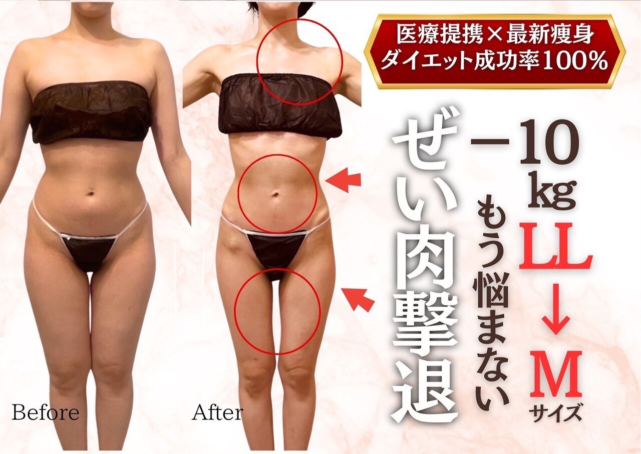 ビューティーワンド ココ(Beauty Wand COCO)｜ホットペッパービューティー