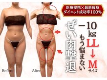 ビューティーワンド ココ(Beauty Wand COCO)