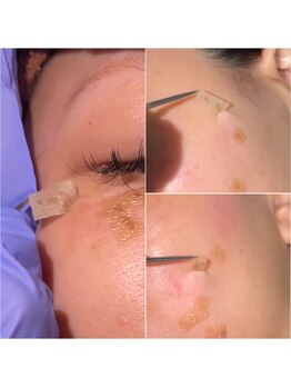 アモ 夢シティ新下関(AMO.)/シミケア