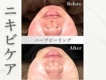 ヴィヴ コレビ(VIV COREBI)の写真