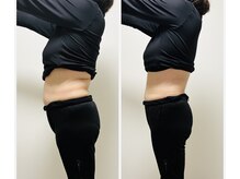 YOSAPARK Lulua/before＊after