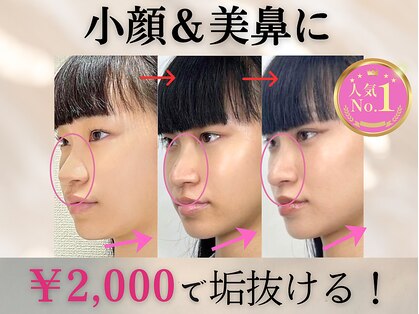 ラプリ 梅田店(Raplit)の写真