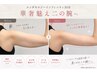 【二の腕集中】最新AI痩身 エンダモロジーインフィニティ30分 ￥9,900