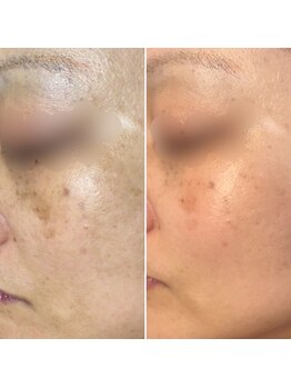 ドルフィン(Dolphin)/★お客様ビフォーアフター