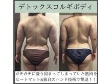 トータルビューティーサロン レビュー(REVIEW)/【Before/After】コルギボディ