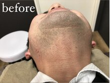 リリーブー 池袋(Lilyboo)/before