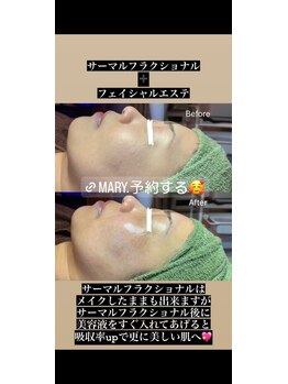 マリー(Mary.)/サーマルフラクショナル