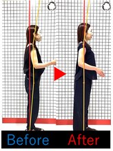 池袋東鍼灸整骨院/姿勢写真