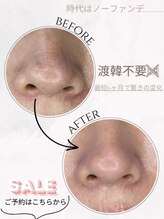 モモ(momo)/洗顔バルブで毛穴の汚れ除去！