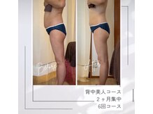 レムロード 川口店/お腹や背中がスッキリ！！