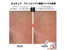 ブーケの雰囲気（触れていたくなるようなつるすべ＆ピカピカでキメの整ったお肌に）