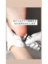 ミシュリーヌ(micheline.)/べべケアスパ/角質除去