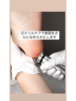 ミシュリーヌ(micheline.)/べべケアスパ/角質除去