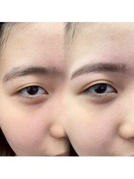 チルアンドアイ 千葉駅前店(Chill&Eye)/美眉スタイリング/BeforeAfter