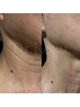 アルルプラス 山科(ARuru+)/【ヴァンパイアマスク】