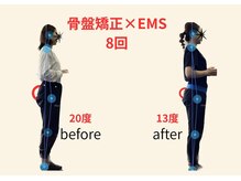 リボーン(REBORN)/整体/骨盤矯正/EMS