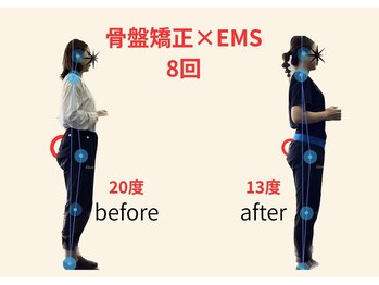 リボーン(REBORN)/整体/骨盤矯正/EMS