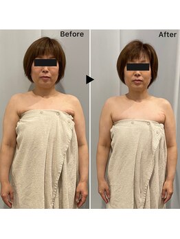 レミュー(Les mieux)/頭から足先まで浮腫みスッキリ！